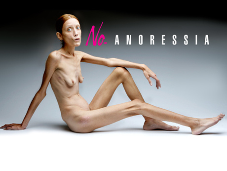 No Anorexia - Nolita