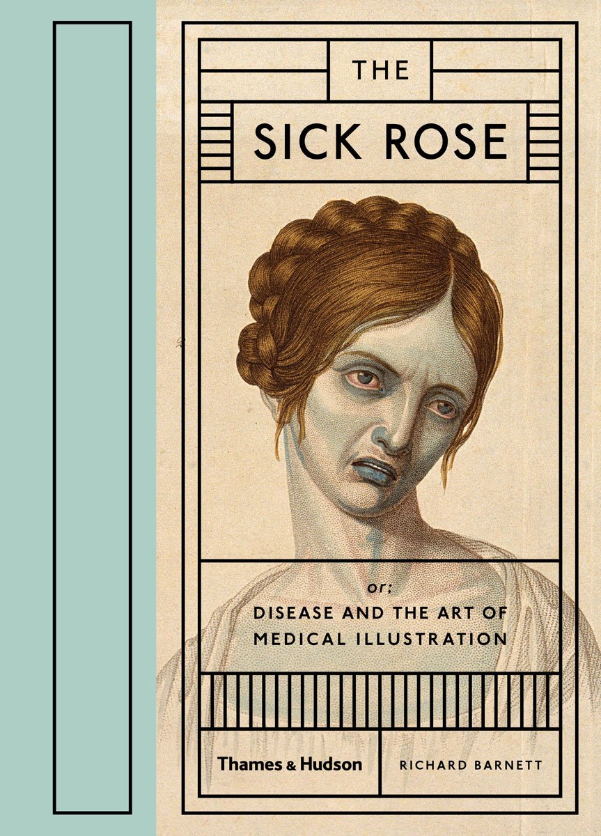 The Sick Rose Frizzifrizzi