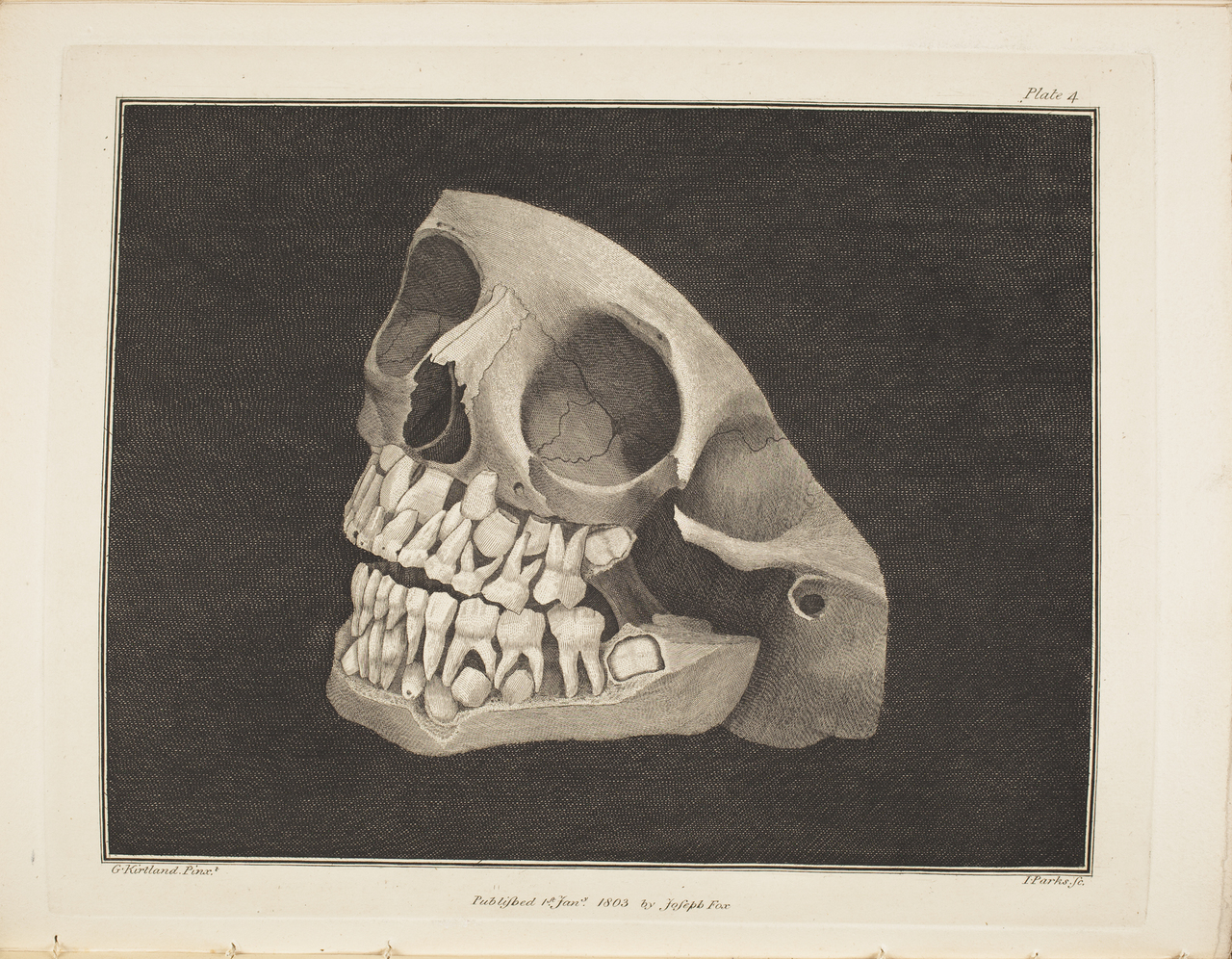 Tavola odontoiatrica. Tratta da “The Natural History of the Human Teeth”, Londra, 1803–6, di Joseph Fox (1776–1816)