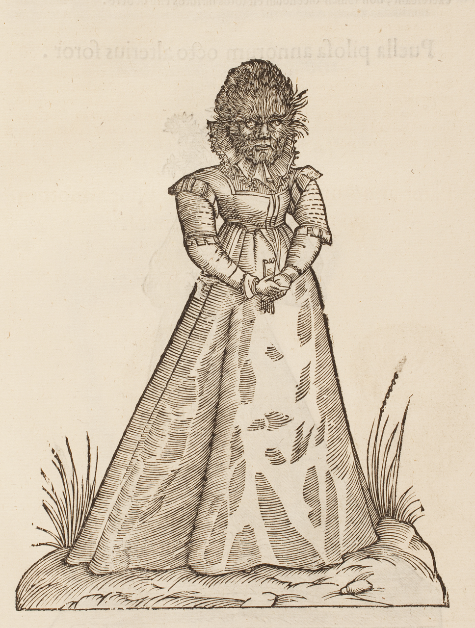 “Puella pilosa annorum duodecim” (bambina pelosa di 12 anni), tratta da “Monstrorum Historia”, di Ulisse Aldrovandi (1522-1605)